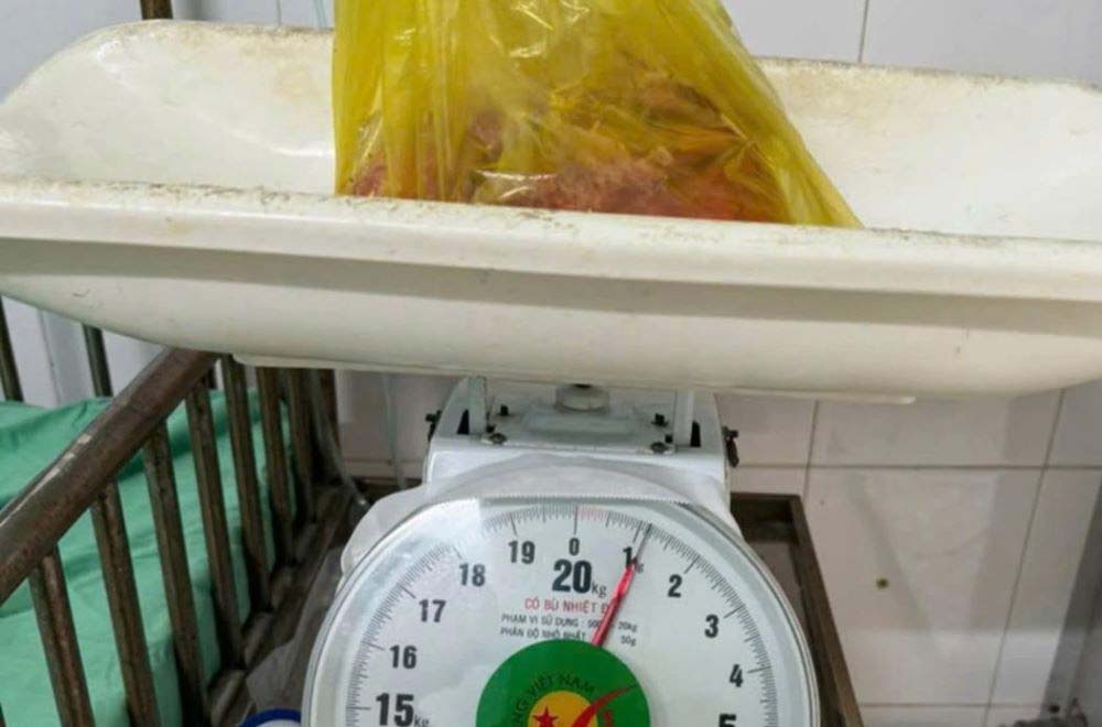 ��Ʈ�� ������ ������ ���� �������� ��ġ�� ��ġ�� 1.2kg���� Ŀ�� ������ ���