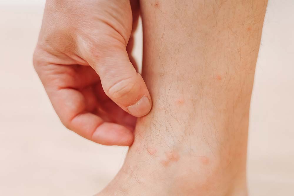 ��� ���� �ٸ�