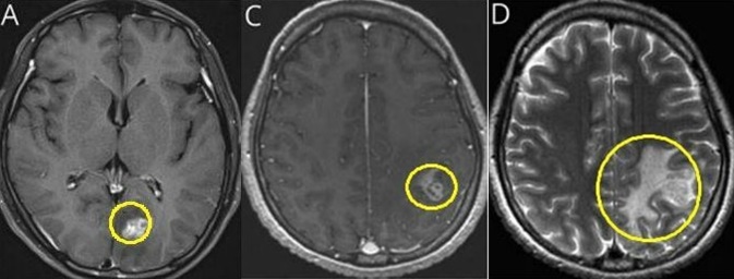  MRI Կ 