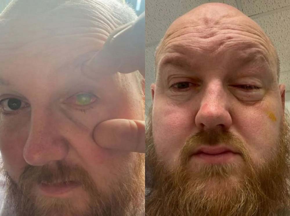 �ܱ��� ���� ���� �ջ�� ����