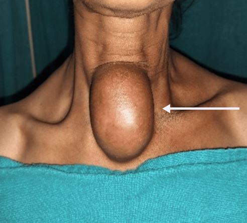 ����� ����