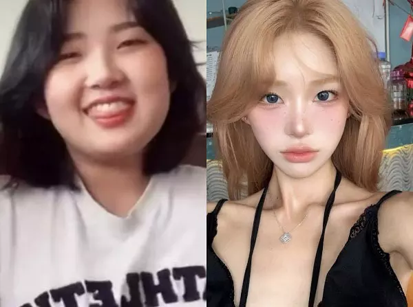 이미지