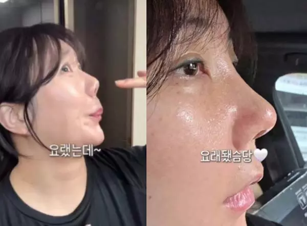 이미지