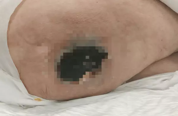 이미지