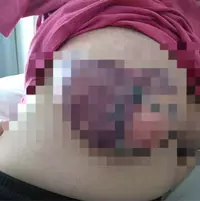 이미지