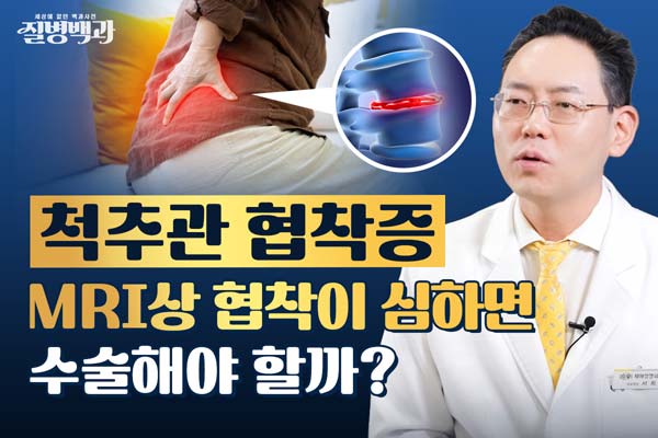 [질병백과 TV] 척추관협착증, MRI 상 협착이 심하면 수술해야 할까?