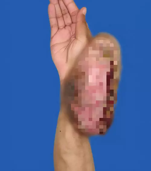이미지