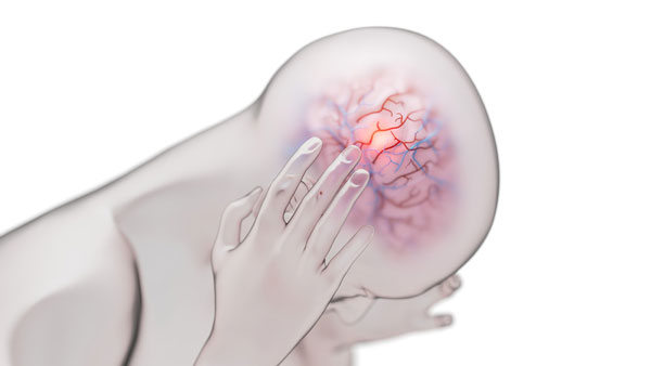 심해졌다 낫기를 반복하는 두통, 빨리 치료해야 하는 ‘이 병’ 탓일 수도