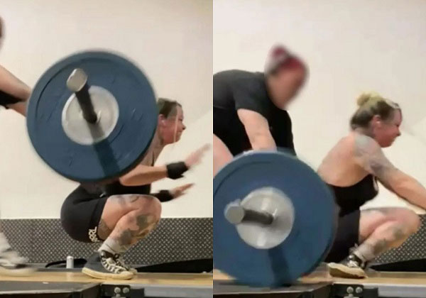 120kg 들고 ‘이것’ 하다가, 발목 동시에 ‘뚝’ 골절… 30대 여성에게 무슨 일이?