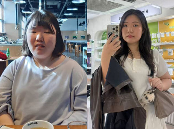 “의사 말 한마디에 정신 번쩍”… 매일 먹던 ‘이것’ 끊고 2년간 45kg 감량