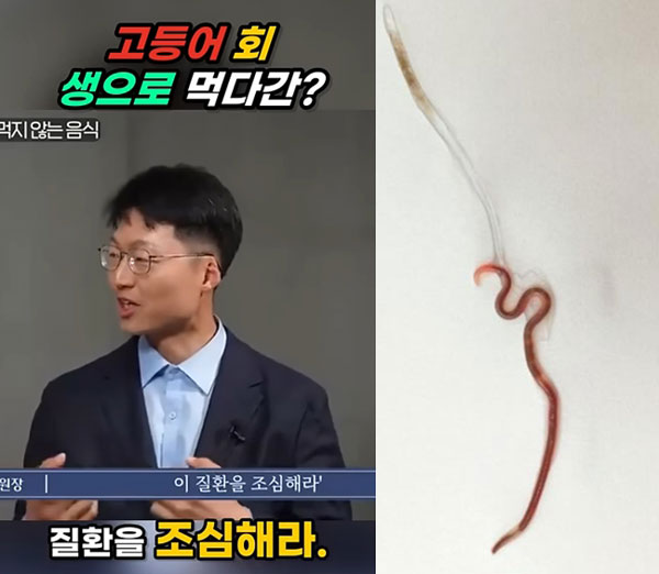 “고등어회 속 ‘이것’ 생각보다 위험” 사망한 사례도… 대체 왜?