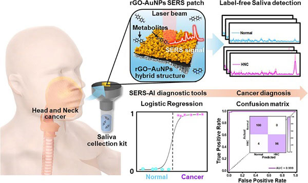 서울성모병원-고려대 공동 연구팀, 비침습적 두경부암 진단 플랫폼 개발