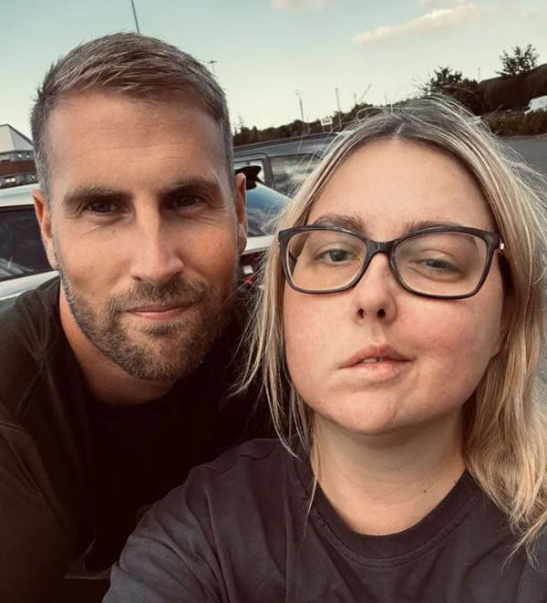 단순 두통이라더니… 10년간 방치했던 30대 女, 결국 안면마비까지