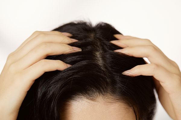 기름진 머리카락… 숨은 질환 신호일 수도