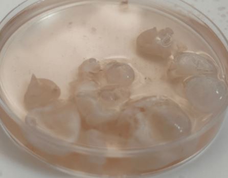 “허리 아프더니, 웬 포도알이 한가득”… 알고 보니 ‘기생충’이었다