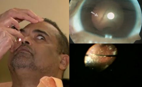 “눈에 수만 마리 기생충이”… 안전하다 생각한 ‘이 음식’이 화근?!