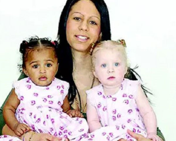 “쌍둥이인데, 아버지가 다르다”… 어떻게 가능한 일인지 봤더니?