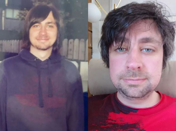 “컴퓨터 하던 중 갑자기 성기가”… 성생활 못 한다는 30대 男, 대체 무슨 일?