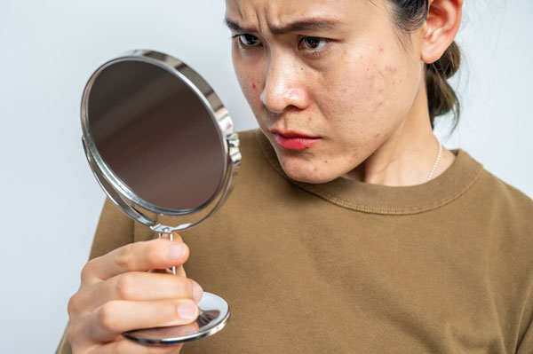 칙칙한 피부는 ‘색소침착’ 때문… 美 전문가가 말하는 개선법, 뭘까?