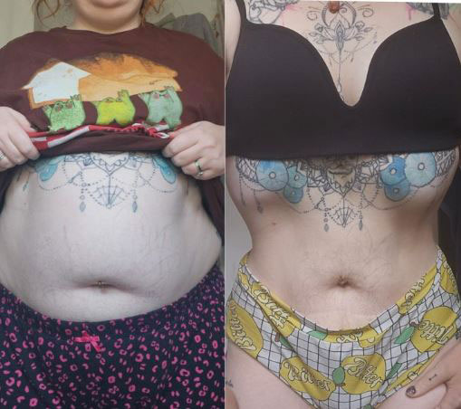 “뱃살 쏙 들어갔네”… 30대 女, 아침으로 ‘이것’ 먹었더니 빠졌다