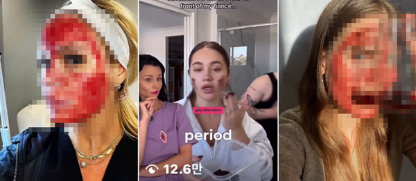 “생리혈 얼굴에 바르면 피부 재생” 기상천외한 마스크, 해외서 인기… 무슨 일?