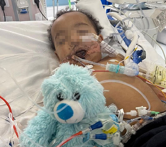 “우유인 줄 알고 ‘이것’마셨다가” 18개월 아기, 심장마비까지… 대체 무슨 일?