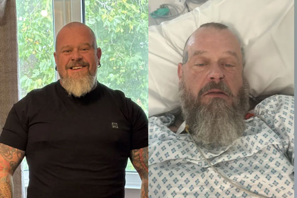 “운동 중 ‘이 증상’ 무시했다가”… 50대 男, 결국 장루 주머니까지