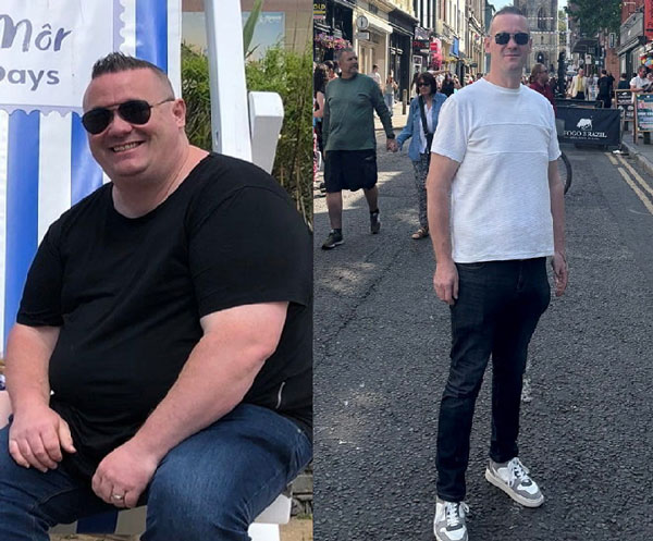 “60kg 감량” 40대男, ‘이 증상’ 겪은 뒤 다이어트 결심… 뭐였을까?