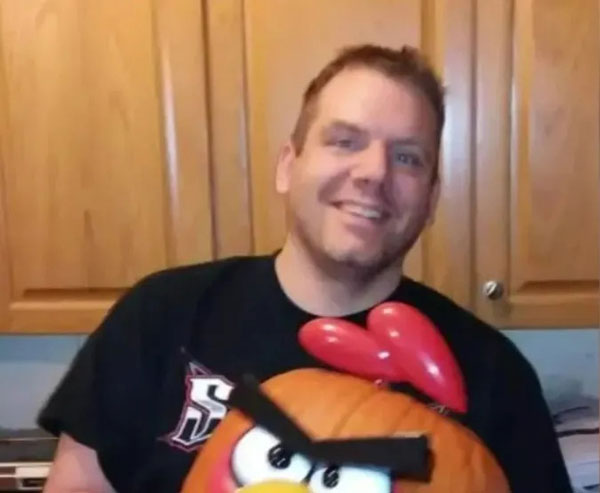 장 막혀 숨진 美 40대 남성, 뱃속에서 ‘이것’ 9kg 나와… 뭘까?