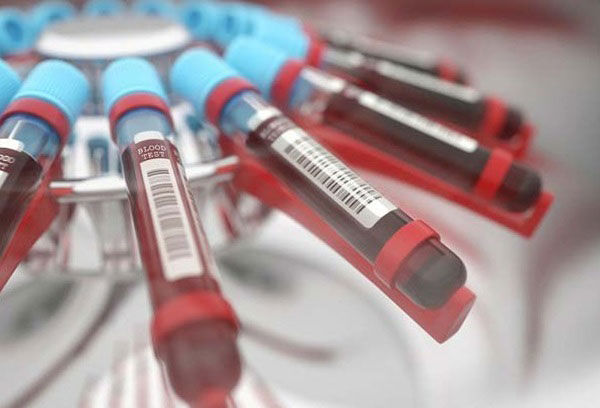 A형인 사람, 肝 건강 주의하세요… 이유는?