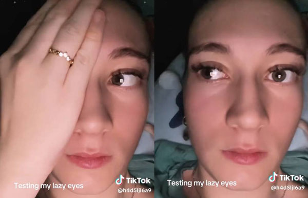 “눈 이리저리 굴리다가 카메라 쳐다보면” 사시 알 수 있다던데… 정말?[SNS 팩트 체크]