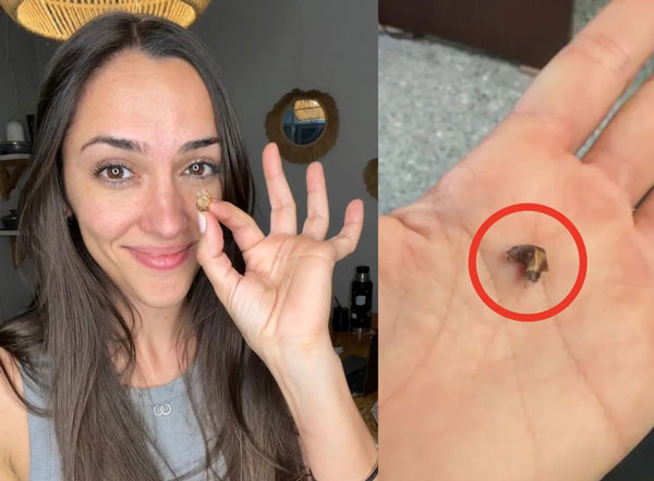 “평생 숨 쉬는 것 어려웠는데”… 35년 만에 밝혀진 女의 비밀, 뭐였을까?