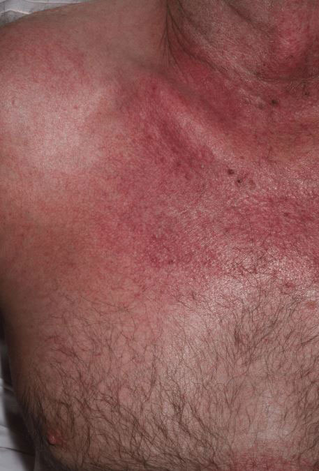 “온몸에 ‘이 증상’ 나타나더니, 결국 사망”… 70대 男, 대체 무슨 일?