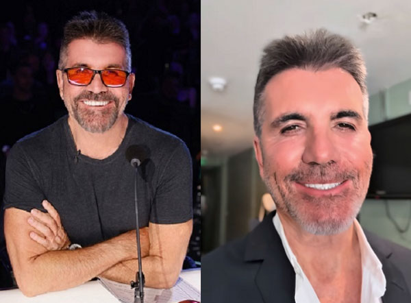 "피 뽑아내 세척한다" 기상천외 시술 경험 밝힌 사이먼 코웰… 무슨 목적?