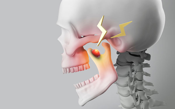 지긋지긋한 턱관절 통증… 스마트폰 앱으로 조절 가능