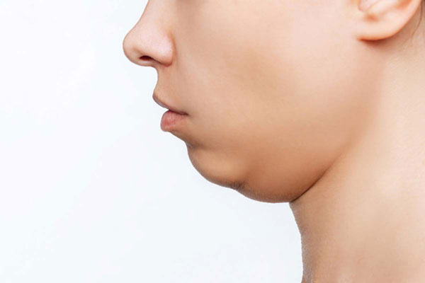 매일 '이것' 먹으면, 퉁퉁 부은 몸 부기 쫙 빠진다