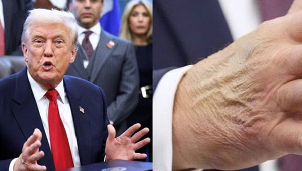 Ʈ������ �տ� �� ��