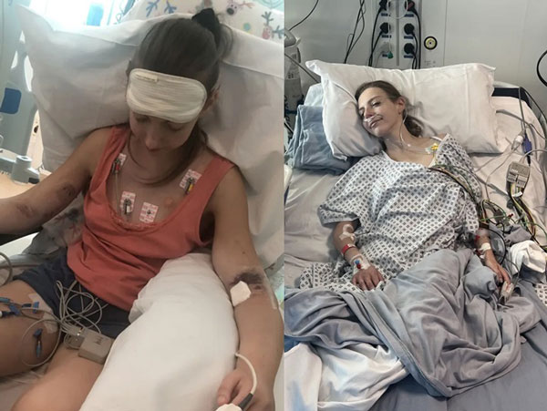 ���� ����뽺