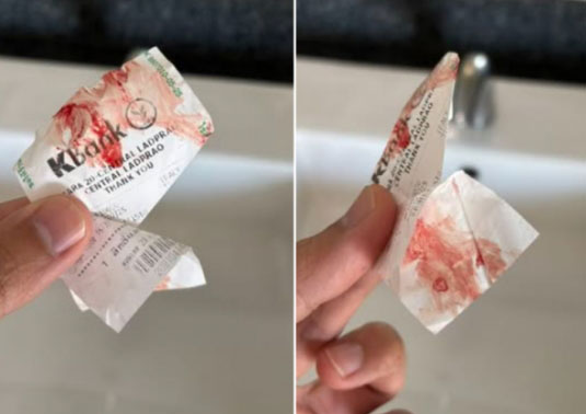 MRT 검사의 장점