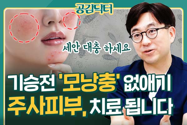 [공감닥터] 홍조, 여드름과 다른 주사피부 ‘이 것’ 제거하면 치료 됩니다