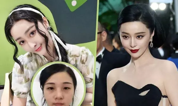 이미지