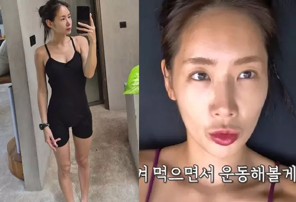 이미지