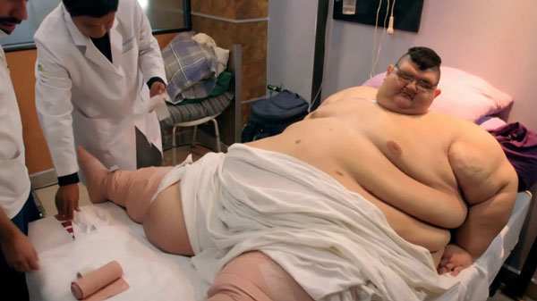 ���� �����ִ� ������