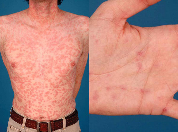 ���� �ö�� ���� �� ����