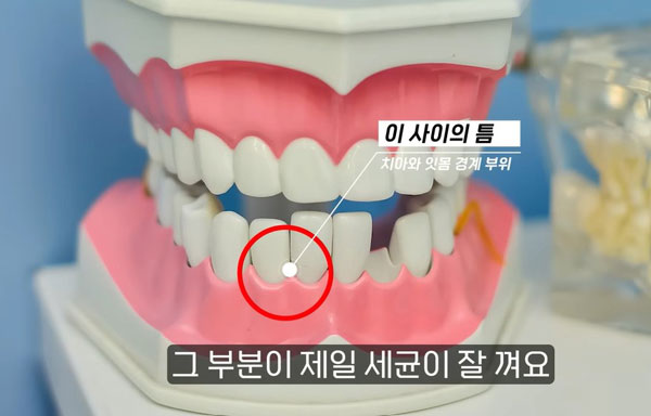 ġ�� �̹���