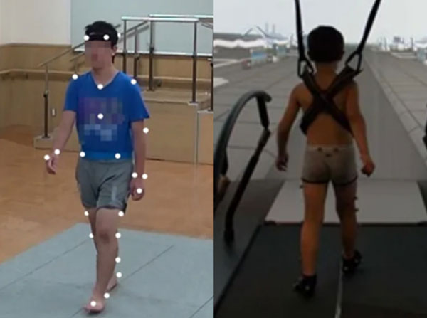 ���̰� �ȴ� ���