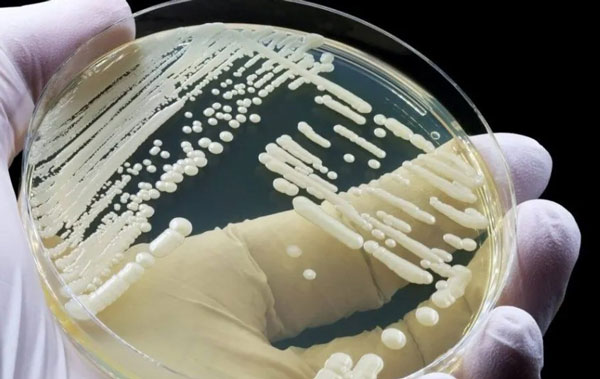 ������ �̹���