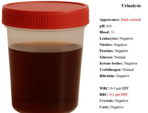 ������ �Һ��� �˻���