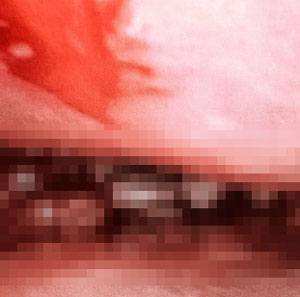 “코에서 치명적인 ‘벌레’ 발견”… 10대 소녀, 감염 경로는?