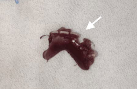 ���ŵ� Ʋ�� ����